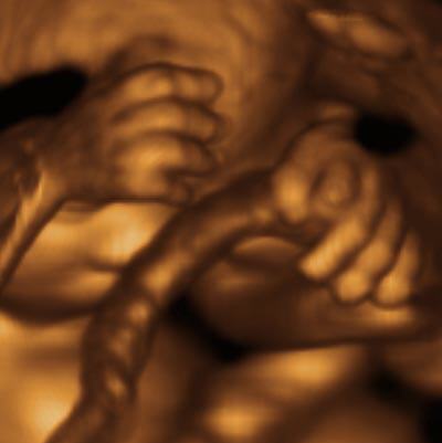 description br�ve de l'image