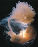L'univers du foetus